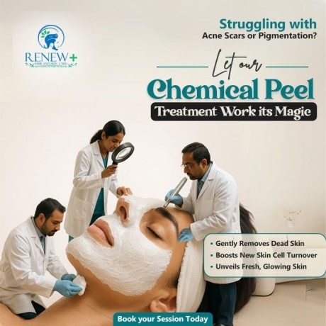 chemical-peel-treatment-advanced-skin-care-solution-big-0